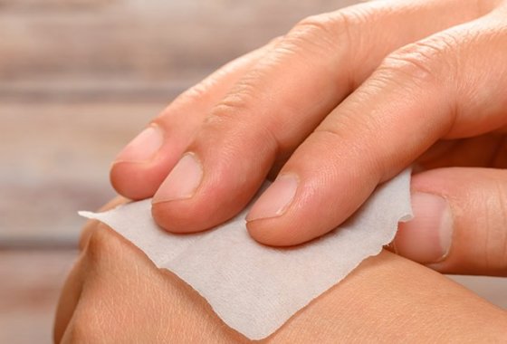 Best Alcohol Prep Pads